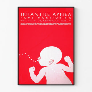infantile-apnea-home-monitoring