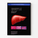 Vintage medical poster on hepatitis C management 2002