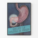 Anatomisch Poster van de Pylorus en Maag - Medisch Muurdecoratie