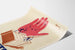 Vintage Poster Safety at Work - First Aid for Splinters